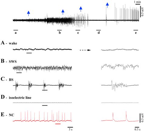 Nu complex isoelectric EEG – Sapien Labs | Neuroscience | Human Brain ...