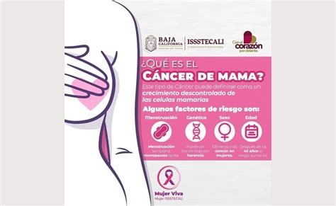 Invita Issstecali A Realizarse Mamografías Para Detección Oportuna Del Cáncer De Mama