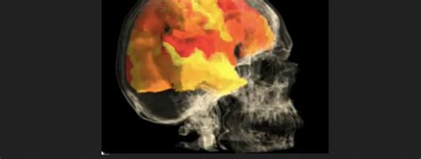 Sex Science Frau Am Rande Eines Orgasmus Im Mri Scanner Wiener Online