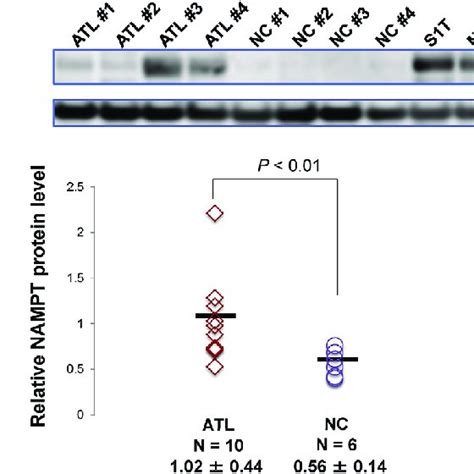 Expression Of Nampt In Pbmcs From Atl Patients A Representative