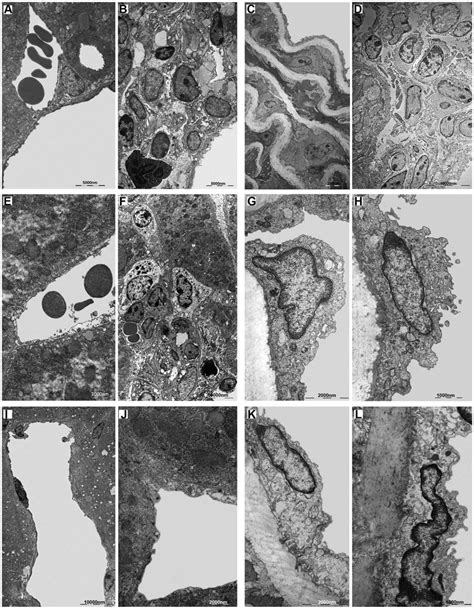 Ultrastructural Analysis Of Murine Infected Tissue Electron Microscopy