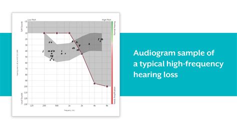 What Is High-Frequency Hearing Loss?