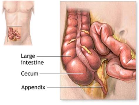 Appendix Pain Location Symptoms Treatment And Surgery Hubpages