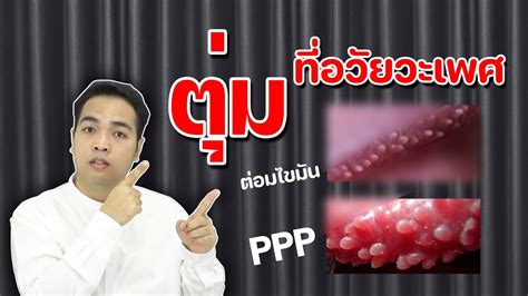 มตมทอวยวะเพศ สาเหตเกดจากอะไร อนตรายไหม EP 2 YouTube