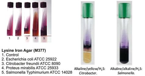 Lysine Decarboxylase Test Reaction