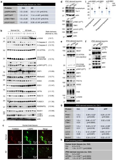 Characterization Of Postmortem Hippocampal Samples And Ipsc Derived