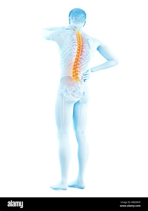 Back pain, conceptual illustration Stock Photo - Alamy