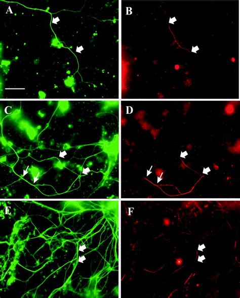 Focal Robo Expression In Neuronal Axons In Embryonic Mouse Spinal Cord