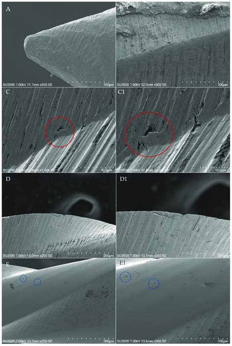 SEM Micrographs Of Metal Defects Microfractures And Pitting Of The 4