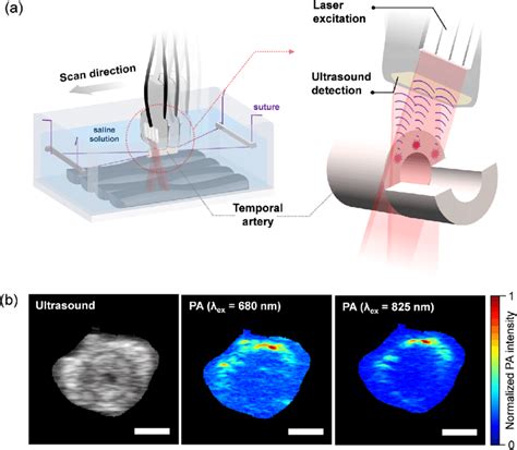 A Illustration Of The Photoacoustic Pa Scanning Setup Used To