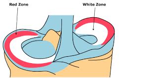 Meniscus Blood Supply Zones