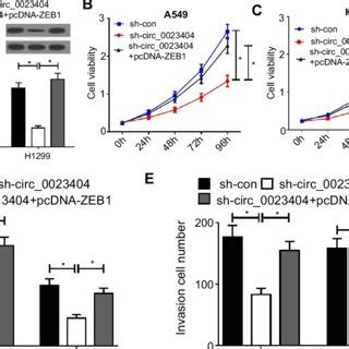 Knockdown Of Hsa Circ 0023404 Inhibits Cell Proliferation Migration