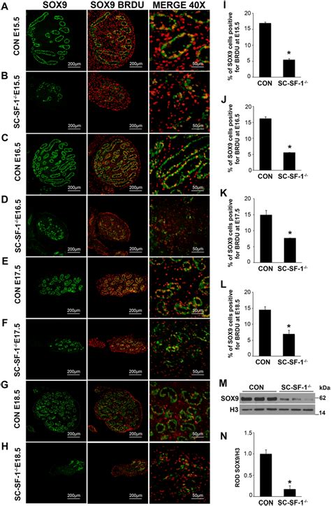 Reduced Expression Of Sox And Loss Of Proliferation Of Sertoli Cells