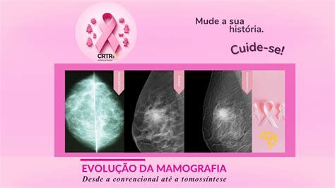 A evolução da mamografia desde a convencional até a tomossíntese