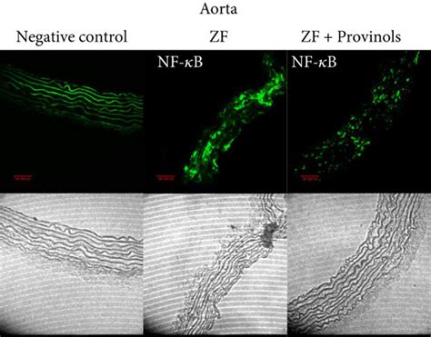 Provinols Modulated The Expression Of Cox Isoforms And Nf κb In Vessels