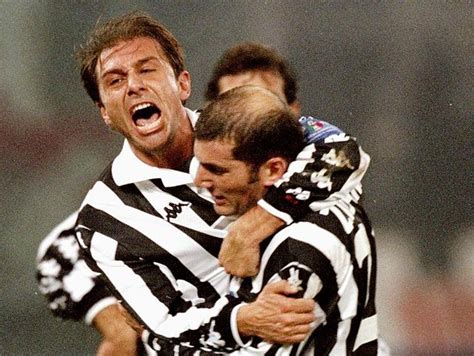 Conte Botak Dini, Kini Gondrong Lagi... Transplantasi adalah Kunci!