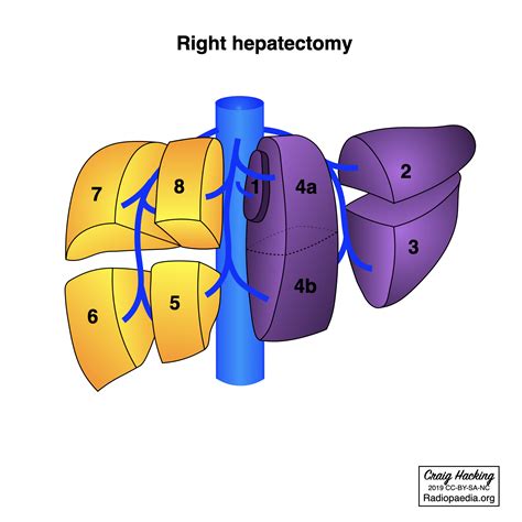 Image Radiopaedia Org