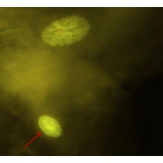 (a) Condensed chromatin (CC), (b) pyknotic nuclei, arrow (PN), (c ...