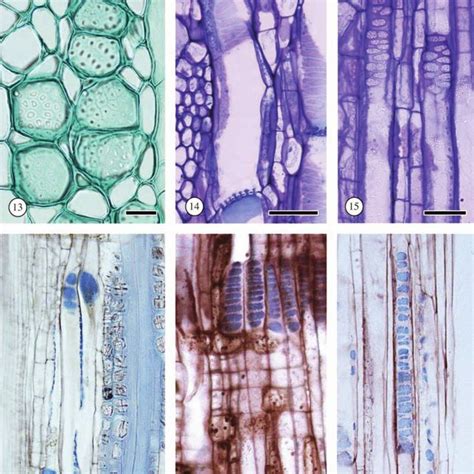 -sieve cells and strasburger cells, gymnosperms.-29: sieve cells (s ...