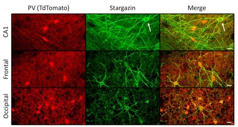 Regional Variation In Stargazin Immunoreactivity In The Hippocampal