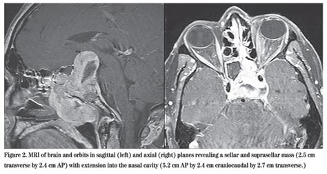 Wills Eye Resident Case Series