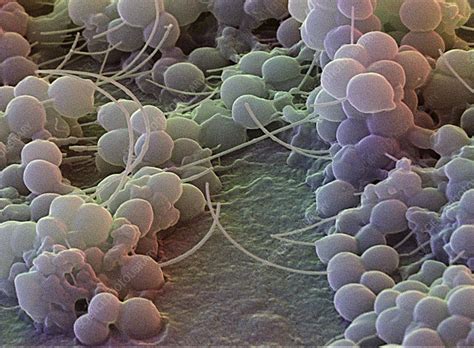 Staphylococcus epidermidis bacteria, SEM - Stock Image - B234/0111 ...