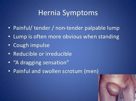 Femoral Hernia Symptoms Men / Hernia's and Groin Swellings / Most ...