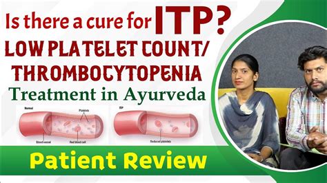 Is There A Cure For Itp Low Platelet Count Thrombocytopenia Treatment In Ayurveda Patient