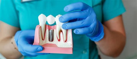 Dental Implants Restoring Your Smile With Permanent Solutions Burnaby