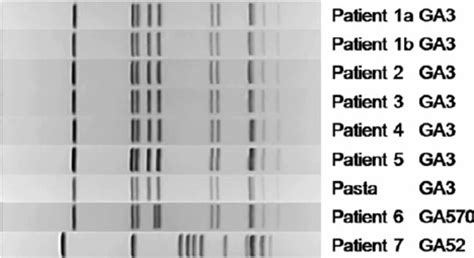 Pulsed Fi Eld Gel Electrophoresis Pfge Pattern Analysis Of Patient