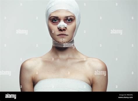 Facelift Modell Stockfotos Und Bilder Kaufen Alamy