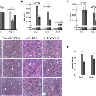 Mcc Treatment Rescues Cytokines Dysfunction In Acute Liver Injury