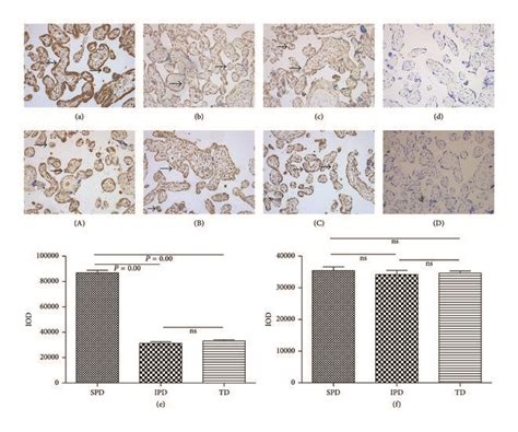 Representative Immunohistochemistry Images For Abca Ac And Abcg