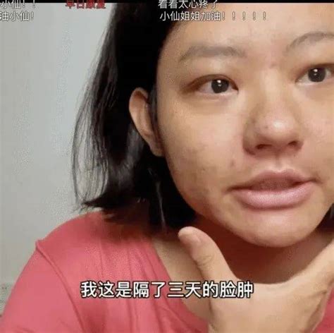 29岁女博主：这个坏习惯害了我！医生劝告：这种病越来越多，4种食物少吃，肾会感激你！ 林晶晶 肾脏 患者