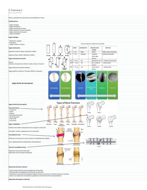 Tipos De Fracturas Parte M Nica Antonella Conforti Jes S Udocz
