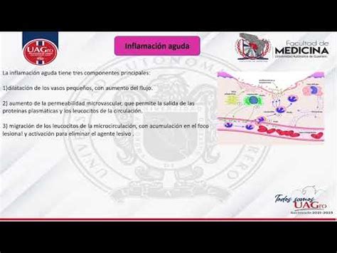 Visión general de la inflamación y reparación tisular YouTube