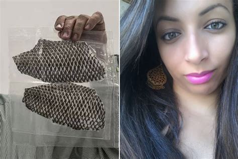 Mundo picante Reconstruyen vagina de brasileña con piel de pescado La Teja