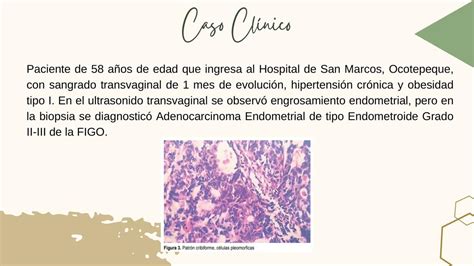 C Ncer Endometrio Caso Cl Nico Valentina Ot Lora Udocz