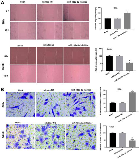 MicroRNA130a3p Promotes The Proliferation And Inhibits The Apoptosis