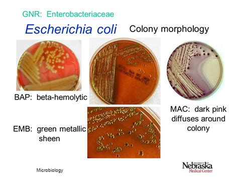 Escherichia Coli Colony Morphology