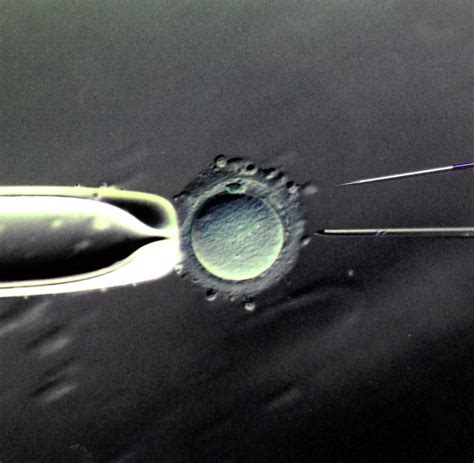 Künstliche Befruchtung - WELT