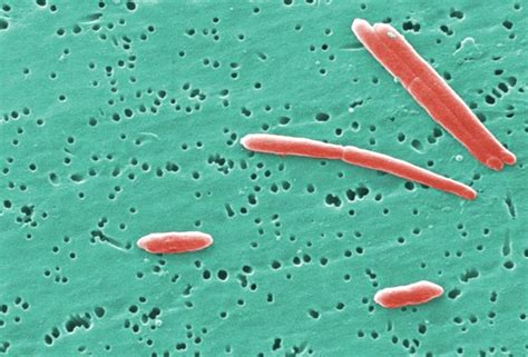 Bacteroides - wikidoc