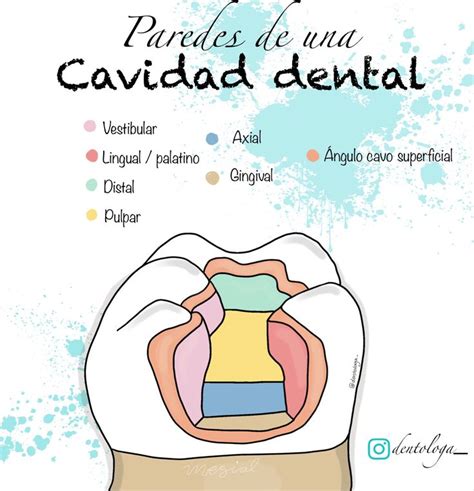 Paredes De Una Cavidad Dental Escuela De Higiene Dental Anestesia En Odontologia Odontología