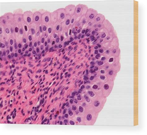 Transitional Epithelium Labeled