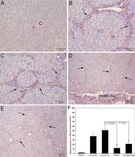 Immunohistochemical Staining Of α Smooth Muscle Actin α Sma In Rat Download Scientific