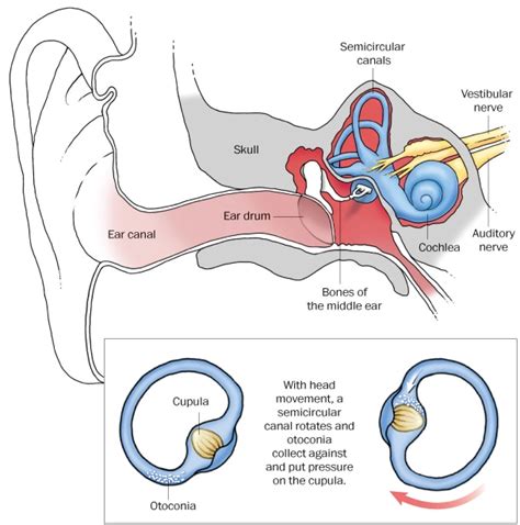 Vertigo Vertigo Inner Ear