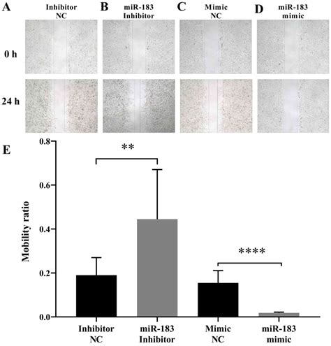 Microrna‑183 Inhibits A375 Human Melanoma Cell Migration And Invasion