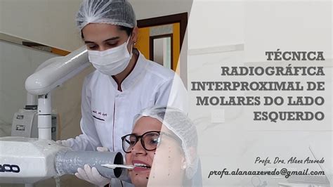 T Cnica Radiogr Fica Interproximal De Molares Do Lado Direito Youtube