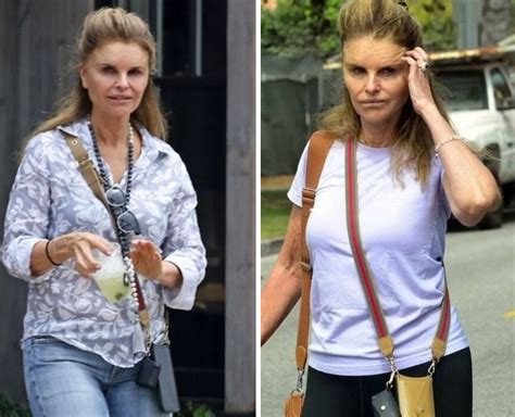 Maria Shriver Before and After Plastic Surgery: Face, Botox