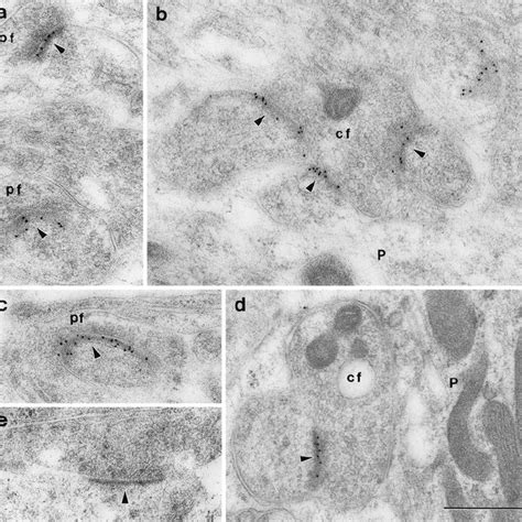 Immunogold Labeling 10 Nm Gold For Delta 12 In The Adult A And